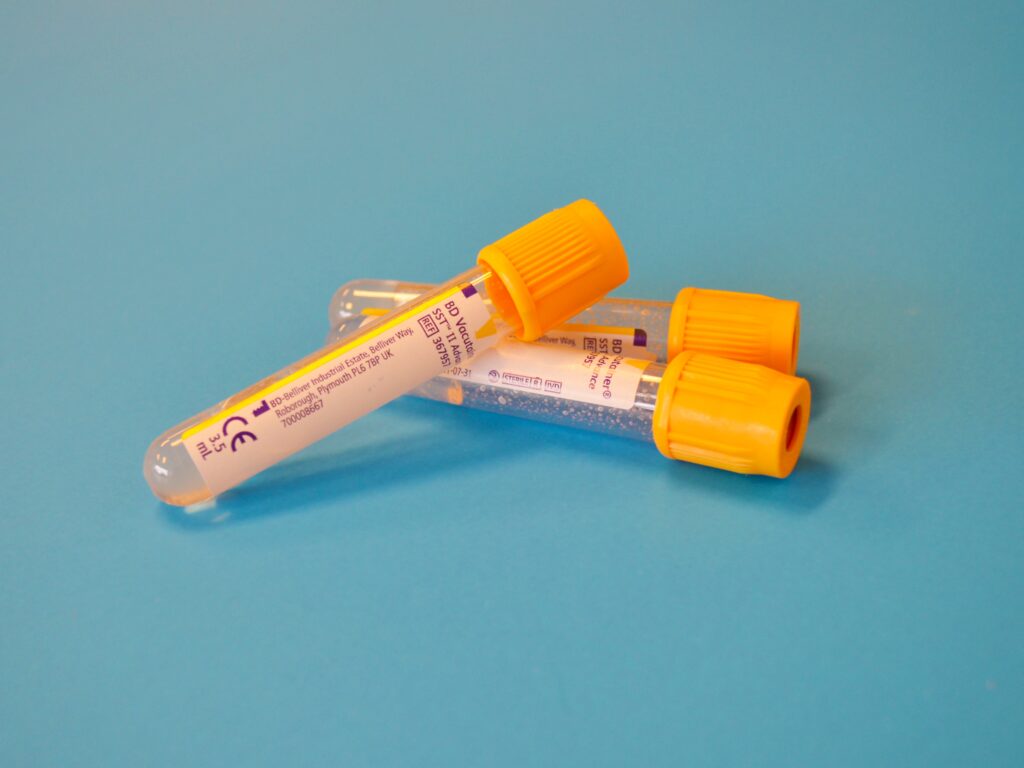 Blood test offers diagnosis for people with mood disorders