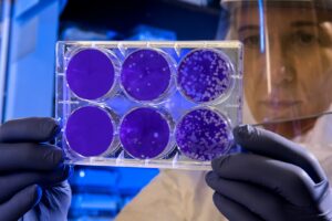Destroying your immune system can help treat MS, study suggests