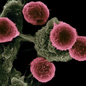 Record number of cancer patients treated in 2022