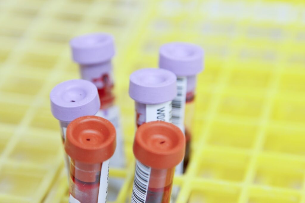 Free HIV at-home test kits rolled out in England this week