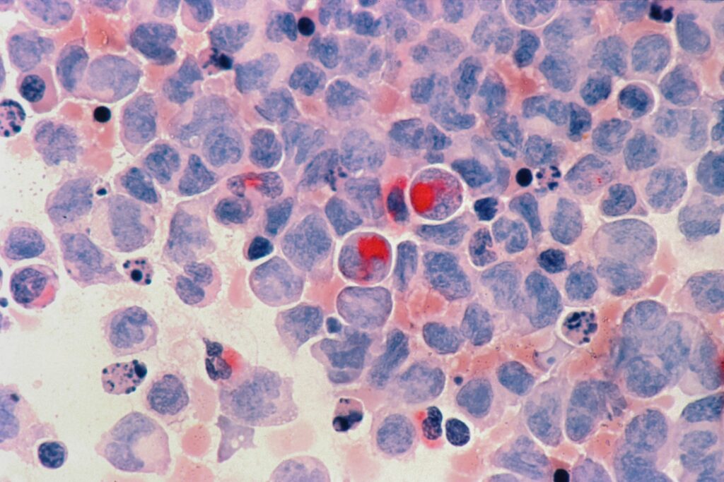 Scientists reveal potential new approach to treating liver cancer