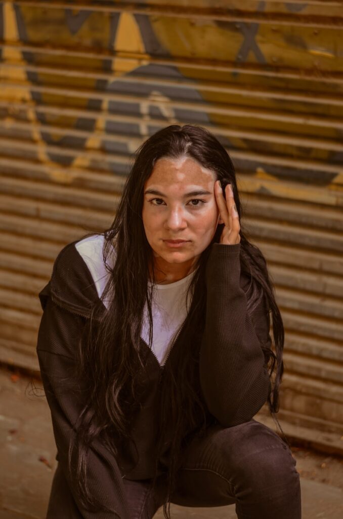 Controversial skin treatment cream could be approved in the UK