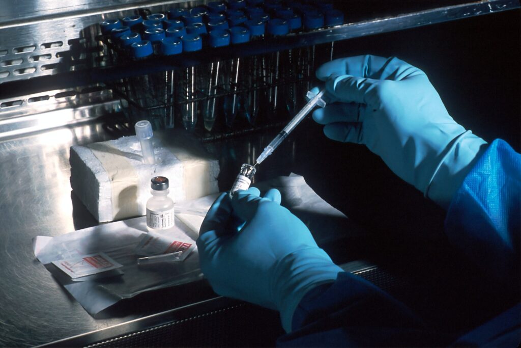 Alzheimer’s breakthrough: scientists have discovered how brain cells die