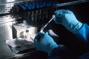Alzheimer’s breakthrough: scientists have discovered how brain cells die